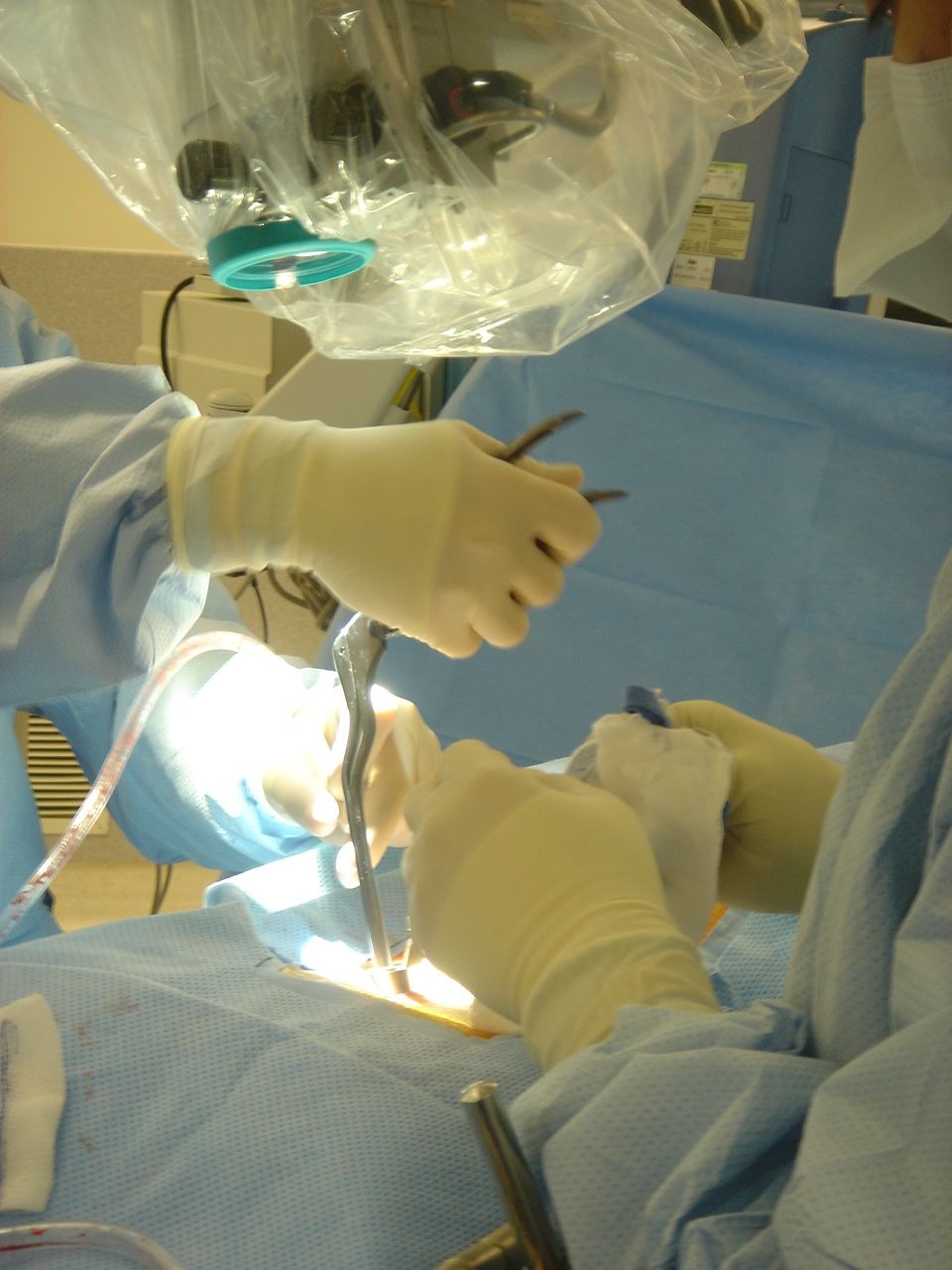 Advanced Spine Surgery Treatment